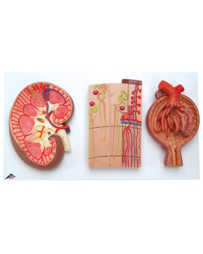 Kidney Section, Nephrons, Blood Vessels and Renal Corpuscle